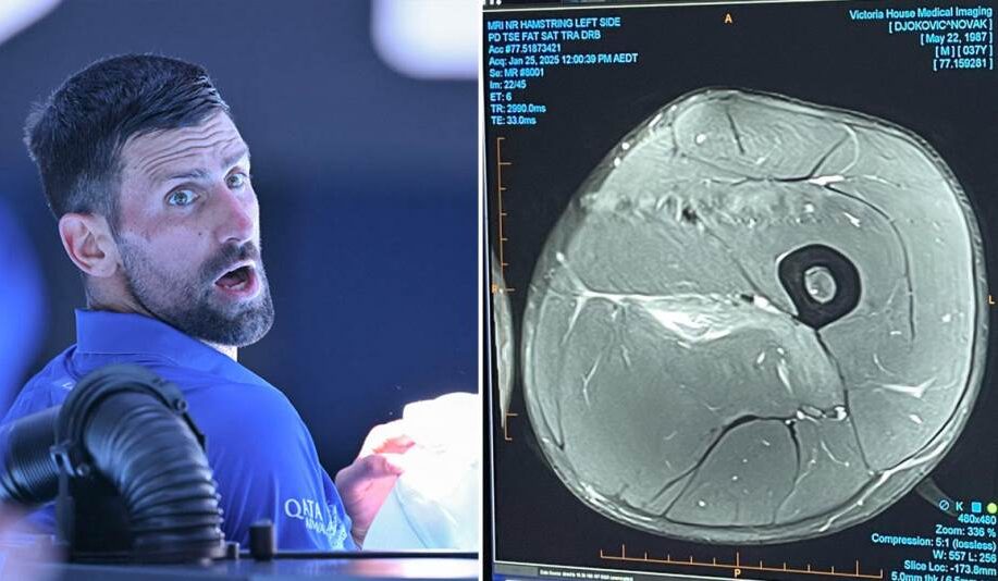 Ove informacije je čekao cijeli svijet: Doktor otkrio detalje Đokovićeve povrede