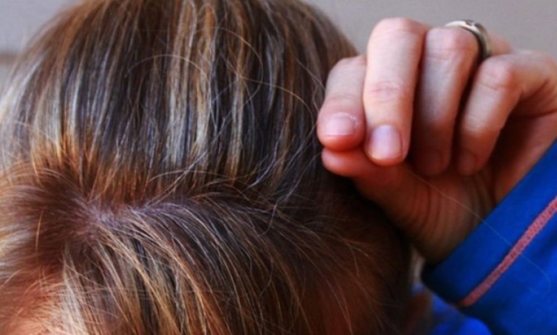 Dermatolozi objasnili: Namirnice koje sprečavaju nastanak sjedih