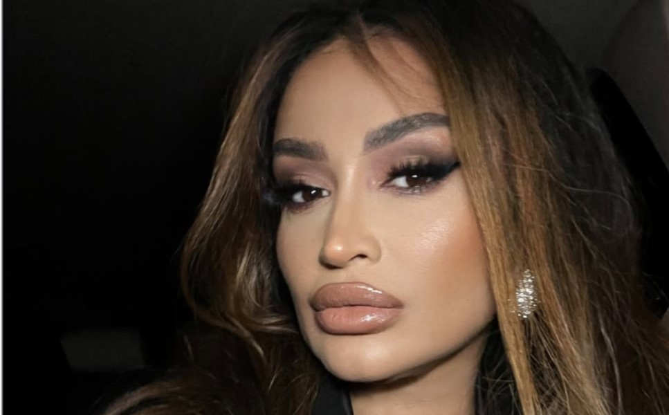 Pjevačica godinama nigdje ne ide bez perike: “Dugo sam skrivala” FOTO