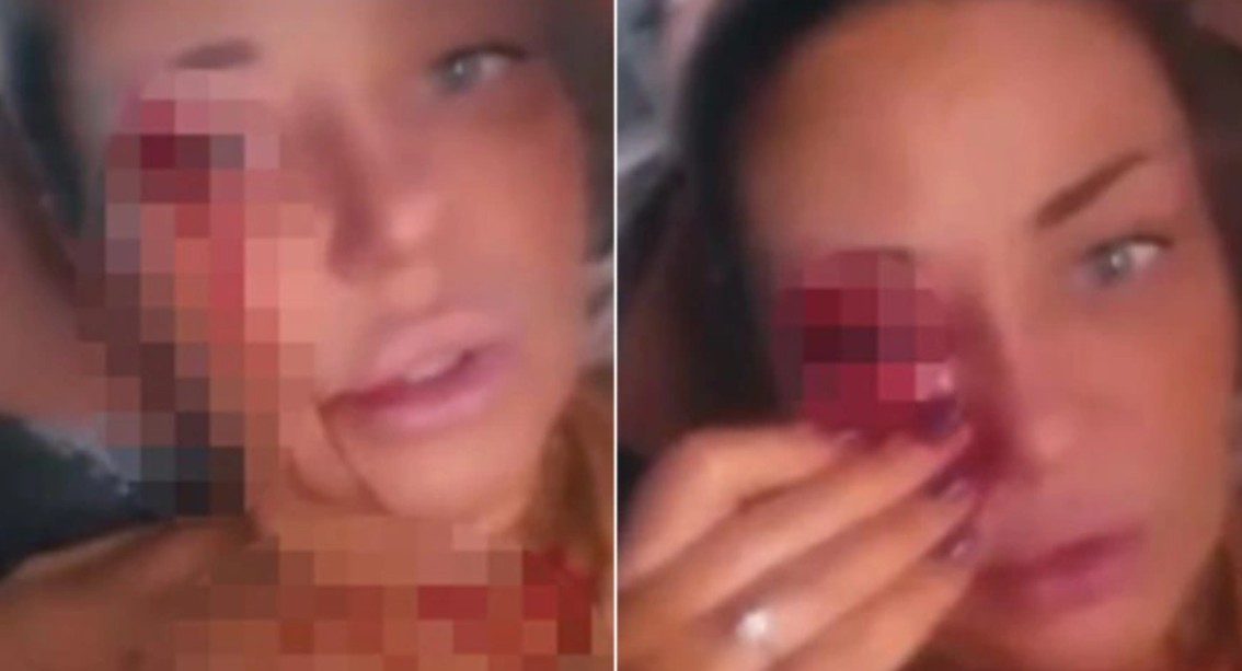 Oglasila se Ana Nikolić poslije krvavog snimka: Objasnila sve