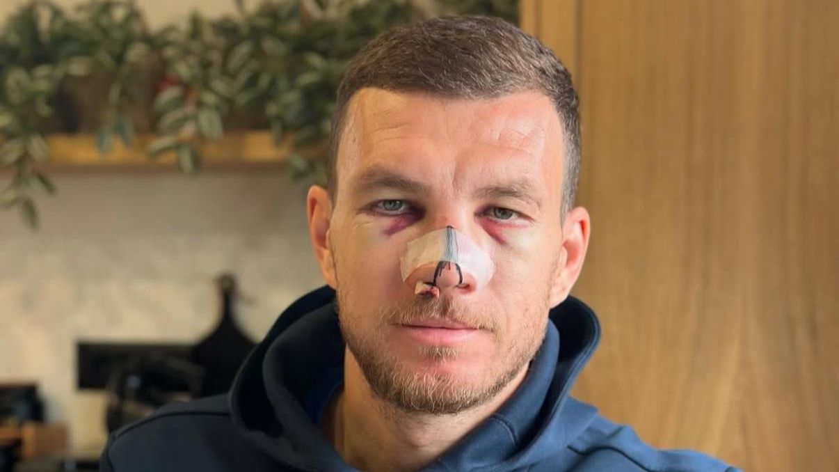 Džeko objavio kako izgleda: “Sve od sebe ili ništa”