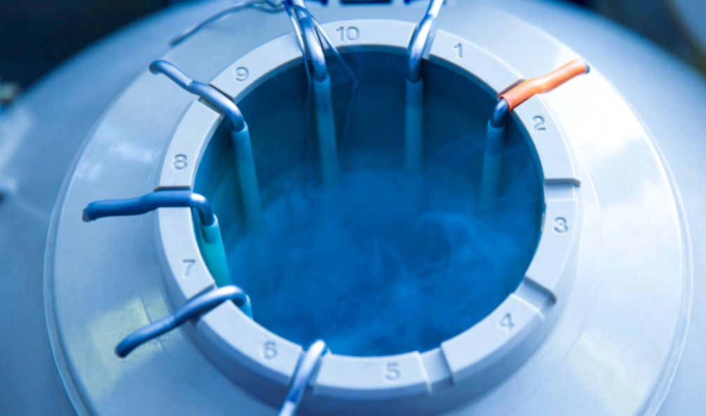 Britanac kriogenski zamrznut: Želio je da se probudi u dalekoj budućnosti