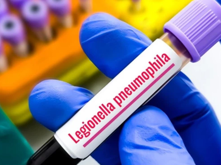 Od tuševa do klima uređaja: Gdje se sve može skriviti opasna bakterija?