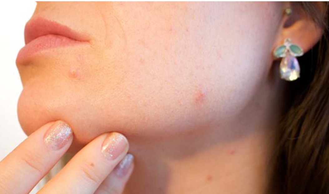 Obratite pažnju: Ove promjene na licu mogu ukazivati na visok nivo šećera u krvi