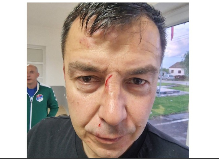 Oglasila se policija: Predsjednik Borca i njegov sin uhapšeni zbog premlaćivanja sudije