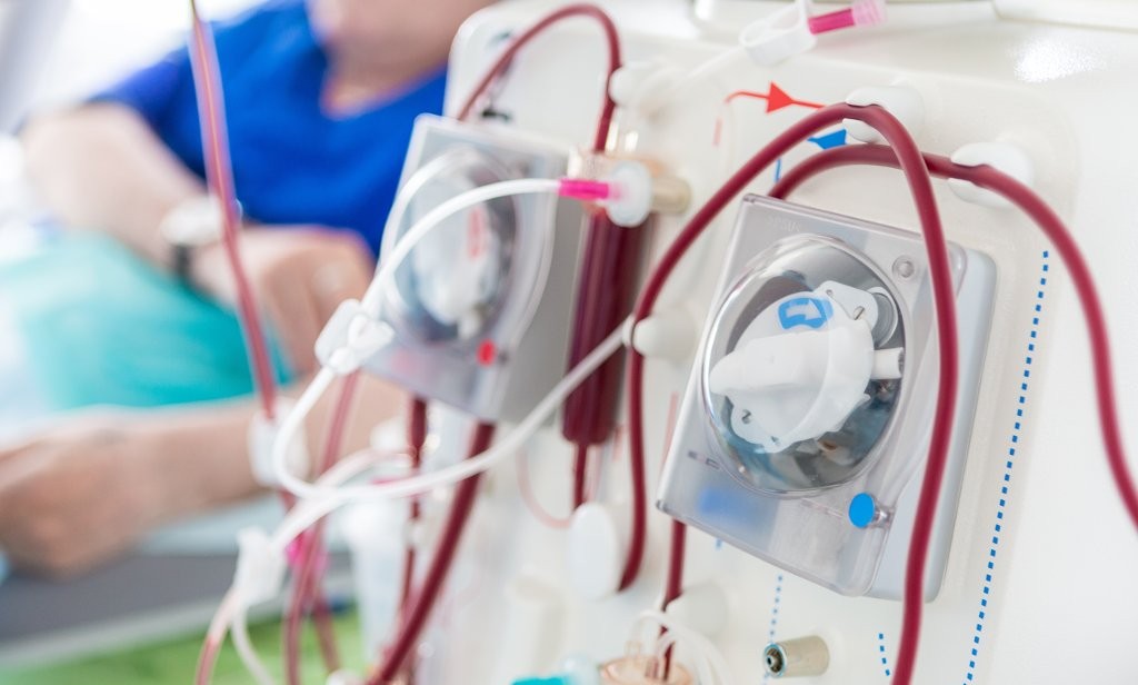 Sad je zvanično: Osniva se zavod za dijalizu i transplantaciju Republike Srpske