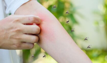 Komarci ne ujedaju slučajno: Evo zašto ujedaju baš vas