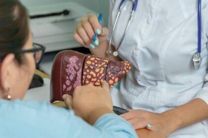 Alkohol nije jedini neprijatelj: Ove namirnice mogu razviti cirozu jetre