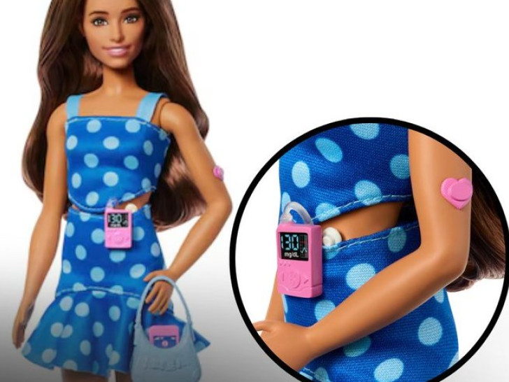 U prodaji prva Barbika s dijabetesom: “Pomaže u oblikovanju ranog pogleda djece na svijet”