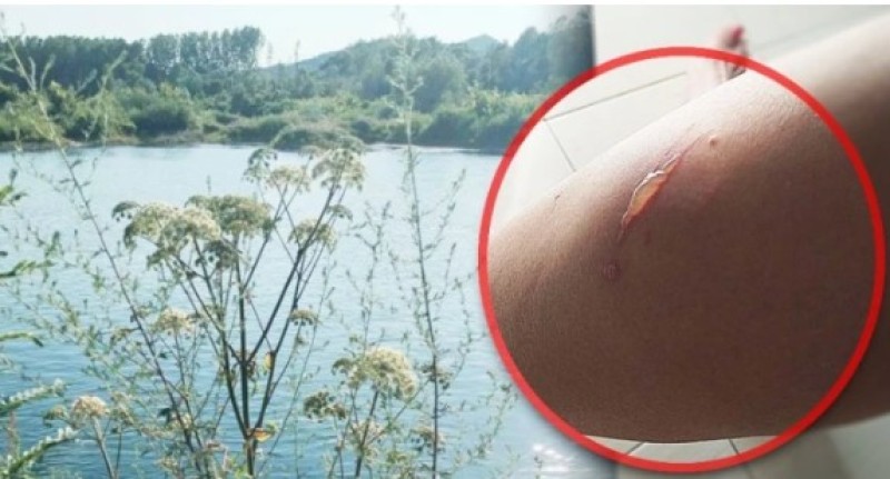 Biljka ”ubica” stigla do Drine? Samo jedan dodir i možete trajno izgubiti vid