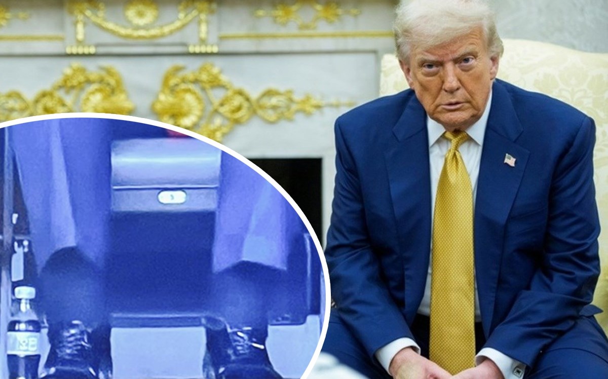 Tramp ima hroničnu vensku insufijenciju: Šta je to i koliko je ozbiljno?