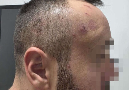 Prva zvanična izjava žrtve policijske brutalnosti u Banjaluci: Prijetili su da će me ubiti i stajali mi nogom na vrat