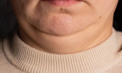 Obratite pažnju: Šta obim vrata govori o vašem zdravlju?