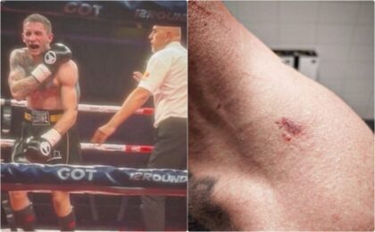 Boks-skandal: Albanac Karadža ujeo Srbina Stojkovića i pobijedio