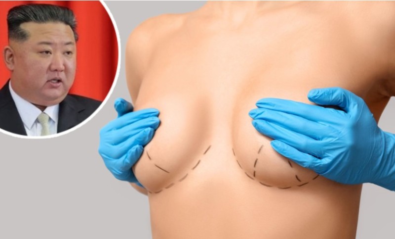 Predsjednik objavio “rat” silikonima: Kim Džong Un zabranio povećanje grudi