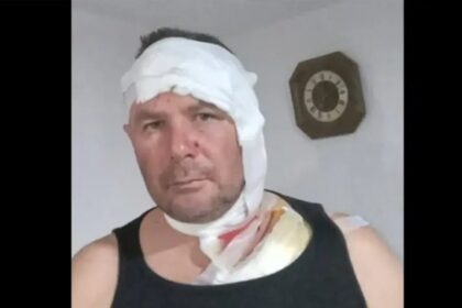 Lovac iz BiH preživio napad medvjeda: Samo sam vidio ogromnu zvijer na meni