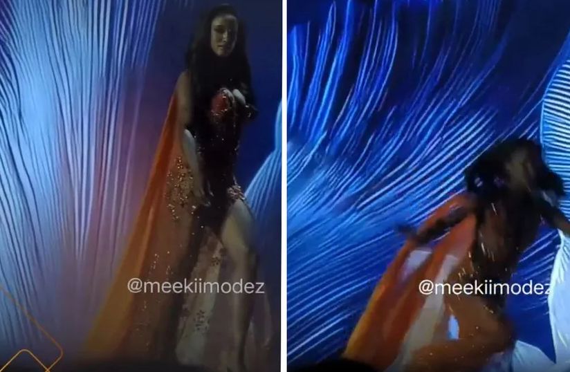 Nakon stravičnog pada sa bine, Mis Jamajke završila na intenzivnoj njezi VIDEO