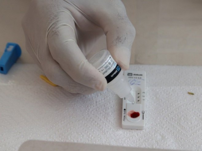 Prevencijom do smanjenja broja oboljelih od HIV-a