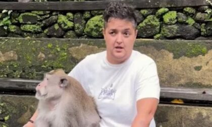 Mariju ujeo majmun! Pjevačica kaže: Sreća, pa je star i ima tupe zube