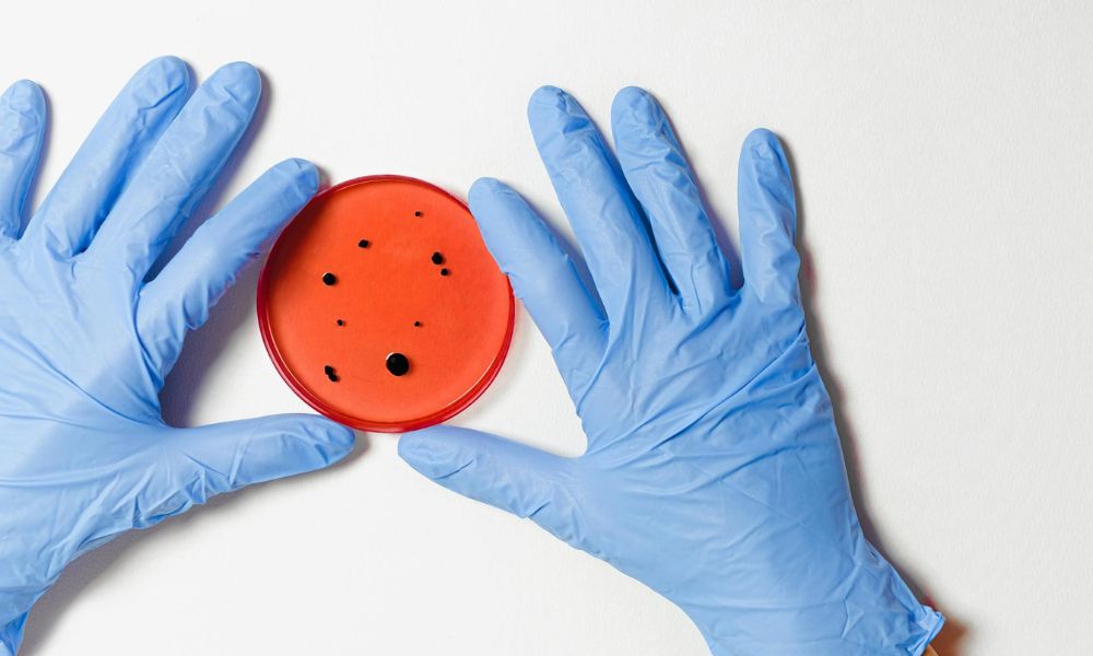 Više od 3.000 zaraženih listerijom u Evropi: Svaka dvanaesta osoba je umrla