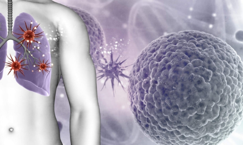 Cistična fibroza u Srbiji: Kako terapija Trikafta mijenja život pacijenata