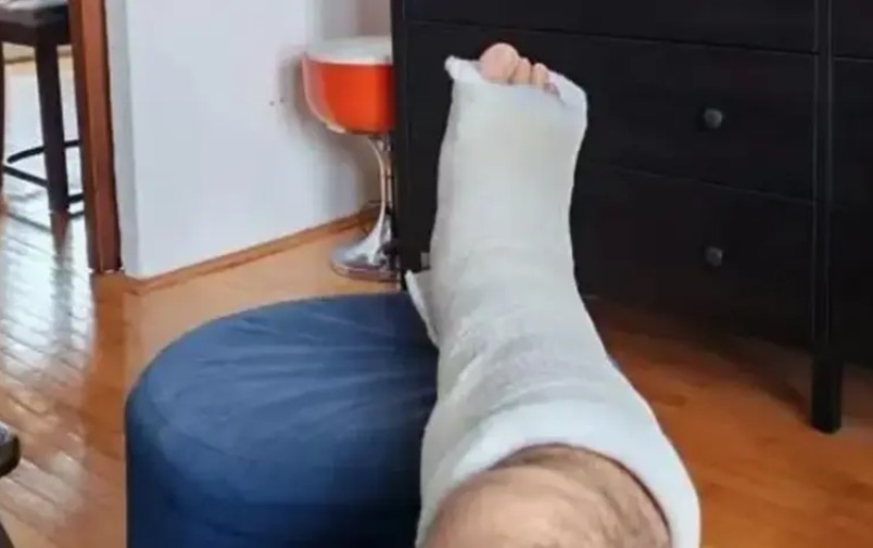 Poznati muzičar doživo težak prelom noge na parkingu: “Puče ko ledenica”