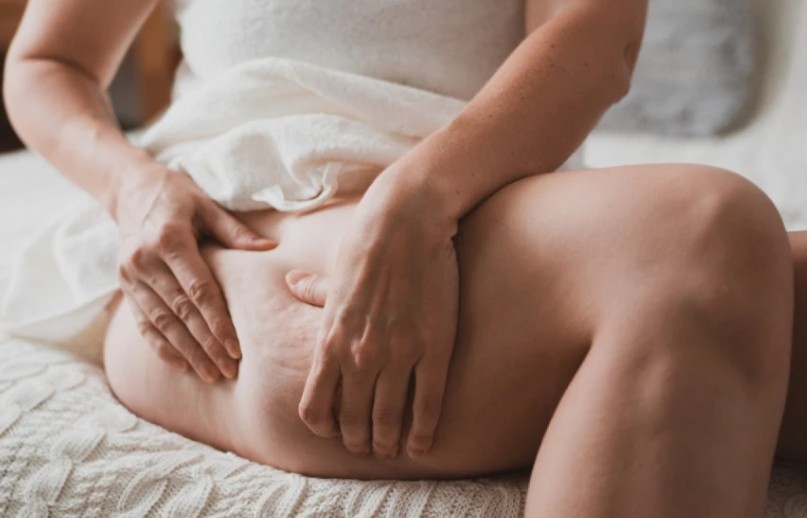 Promjena na tijelu: Konzumiranje ovih namirnica smanjuje pojavu celulita