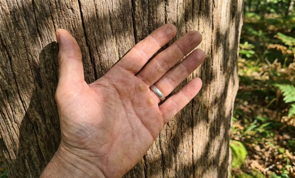 Šta znači ako vas svrbi lijevi dlan? Nije samo novac u pitanju…