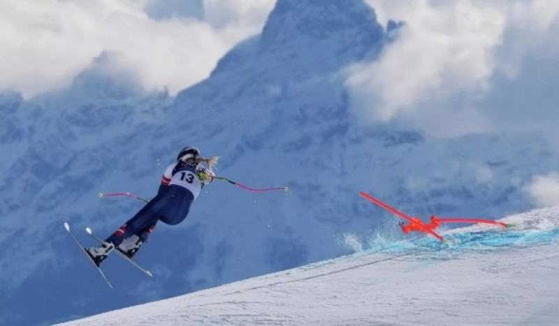 Lindzi Von puštena iz bolnice: Bila sam korak od amputacije noge VIDEO