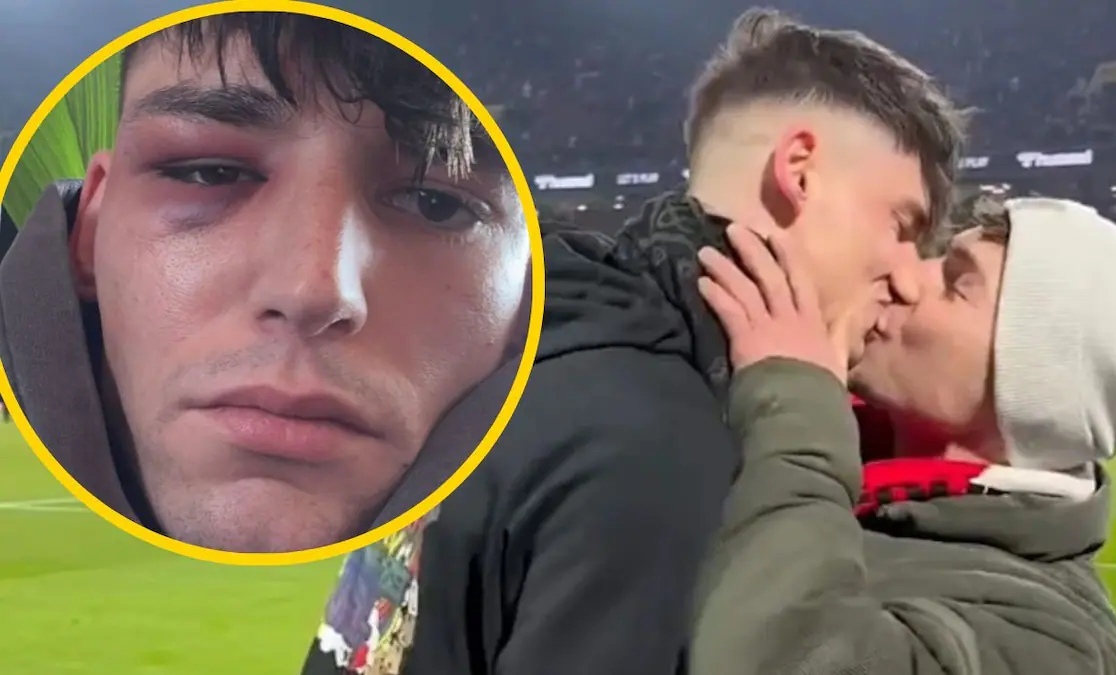 Od ovacija do napada: Pretučen fudbalski sudija nakon prosidbe na stadionu VIDEO