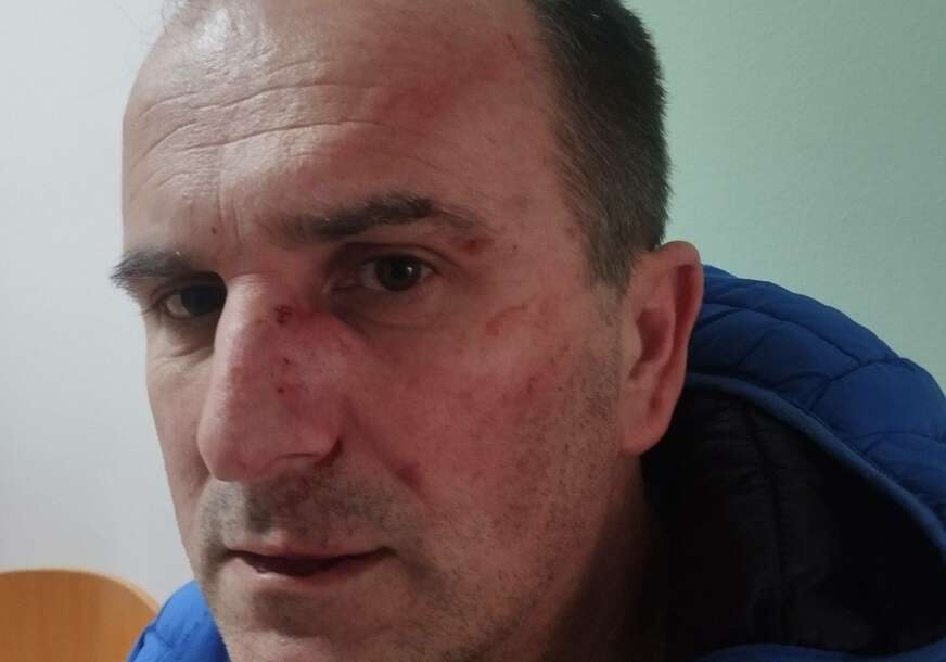 U toku kriminalistička obrada: Uhapšen osumnjičeni za napad na aktivistu SDS u Pelagićevu