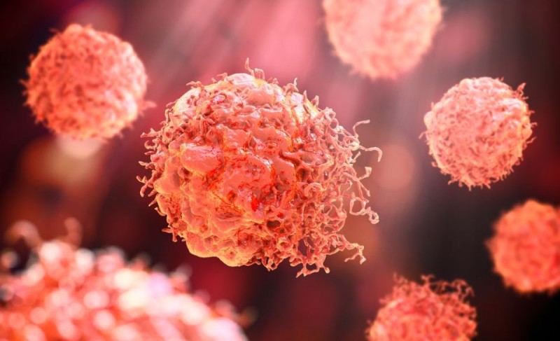 Kraj dilemama: Onkolog i psiholog objašnjavaju da li je moguće “prizvati” rak