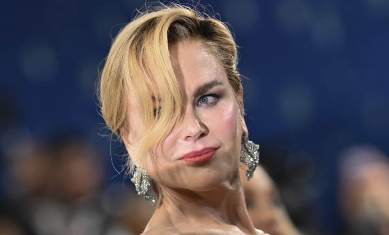 Nikol Kidman surovo napadaju: “Ovo je tako loše, sve se vidi”