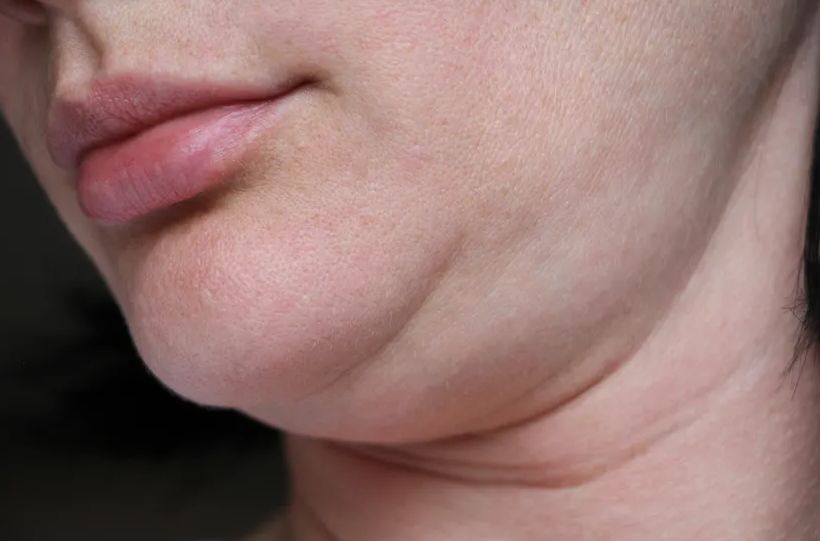 Punije lice i podbradak? Ove navike mogu pomoći da izgubite masnoću iz lica