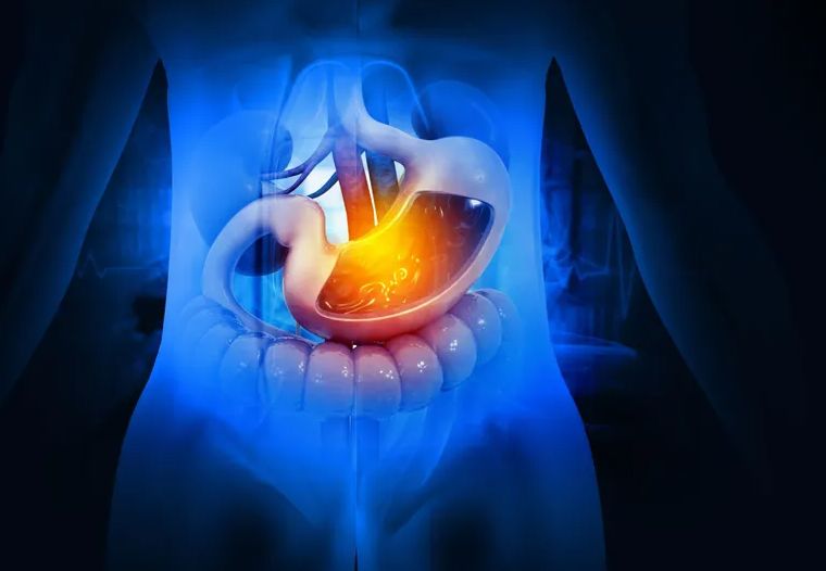 Gastritis često ne karakteriše bol u želucu, neki simptomi prođu „ispod radara“