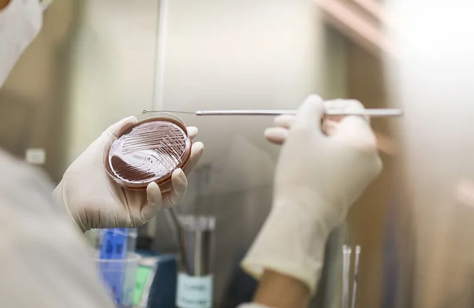 Gonoreja i hlamidija, a ne vaginalna gljivična ili bakterijska infekcija, kako da razlikujemo ova stanja