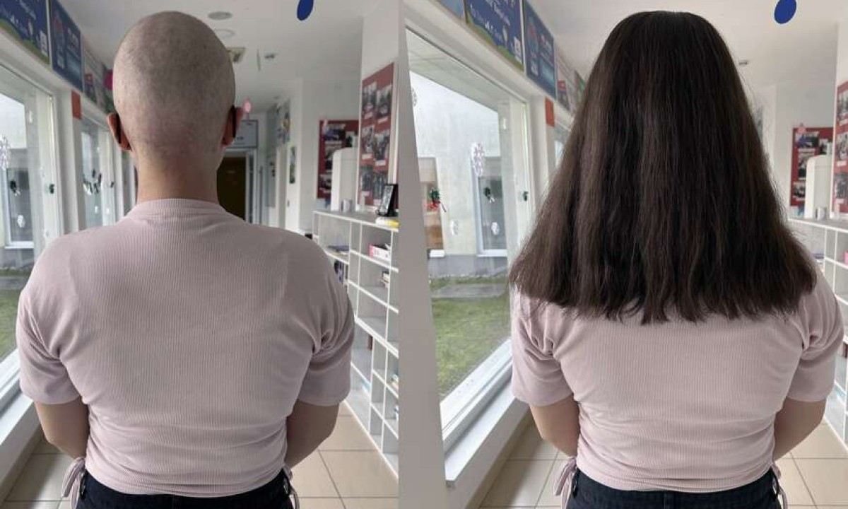 Heroine koje vraćaju nadu: Nekada izgubile kosu zbog terapija, danas je daruju drugima FOTO