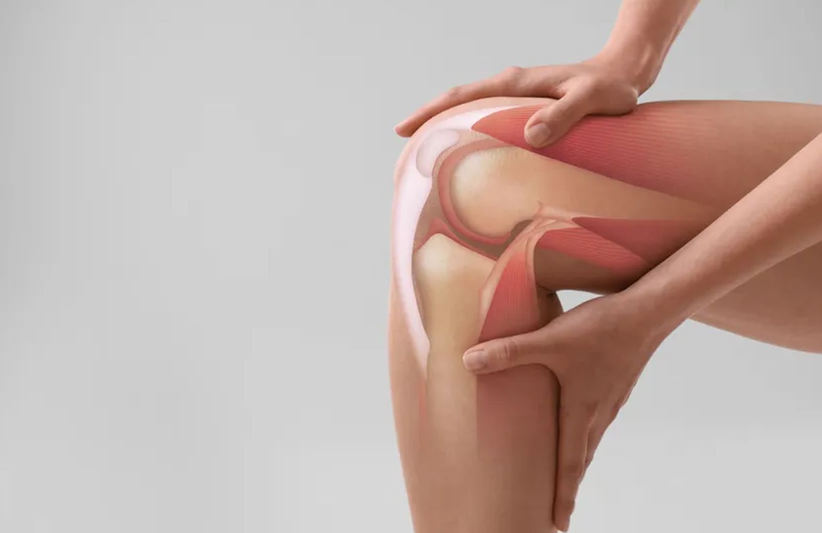 Operacija koljena (parcijalno uklanjanje meniskusa) može da pogorša osteoartritis, tvrde naučnici