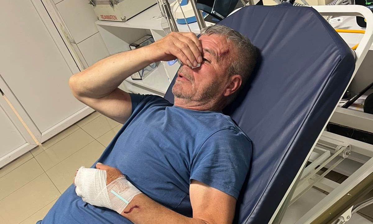 Verbalna svađa prerasla u fizički obračun: Albanac brutalno pretukao Srbina