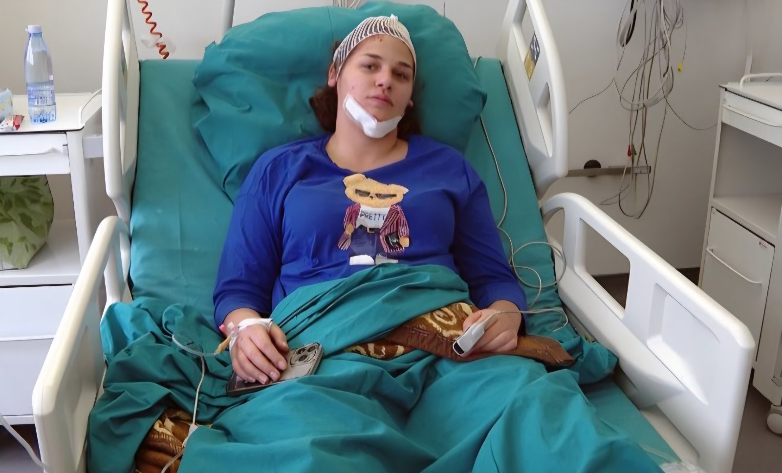 Ljubojevićeva preuzela odgovornost: Ima slomljeno rebro i potres mozga