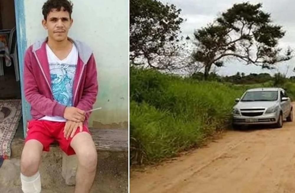 Nevjerovatna prevara šokirala Brazil: Odsjekao sebi stopalo zbog osiguranja