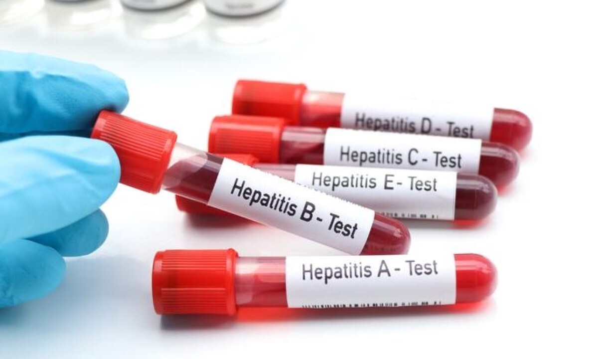 Svjetski dan borbe protiv hepatitisa: U Srpskoj ove godine prijavljeno 29 slučajeva