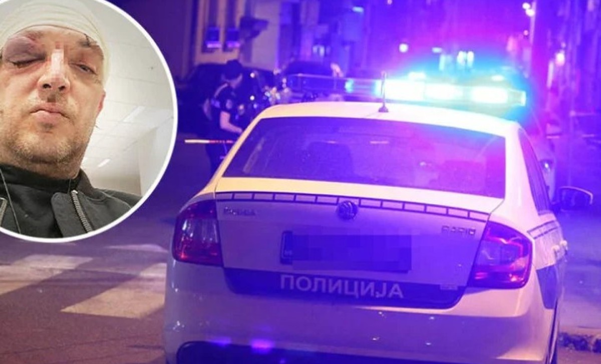 Odbija saradnju s policijom: Zoran Marjanović pretučen zbog 20 godina mlađe djevojke!?